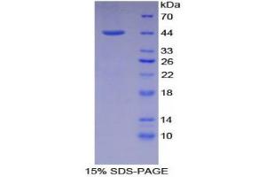 SDS-PAGE (SDS) image for Natriuretic Peptide A (NPPA) (AA 25-152) protein (His tag,GST tag) (ABIN1169923) (NPPA Protein (AA 25-152) (His tag,GST tag))