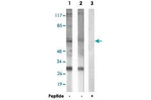 Western blot analysis of extracts from HepG2 cells (Lane 1) and COLO 205 cells (Lane 2 and 3), using MITF polyclonal antibody . (MITF antibody  (Ser73, Ser180))