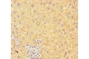 Immunohistochemistry of paraffin-embedded human liver tissue using ABIN7144096 at dilution of 1:100 (C19ORF80 antibody  (AA 22-198))