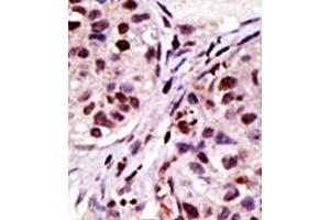 Image no. 2 for anti-Hepatocyte Growth Factor-Regulated tyrosine Kinase Substrate (HGS) (N-Term) antibody (ABIN357582)