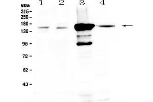 Western blot analysis of PRX using anti-PRX antibody . (Periaxin antibody  (AA 1-91))