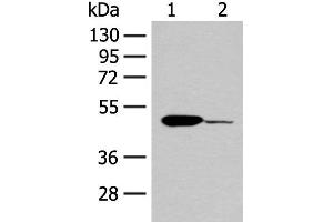 Western blot analysis of Mouse heart tissue and K562 cell lysates using ACOD1 Polyclonal Antibody at dilution of 1:400 (IRG1 antibody)