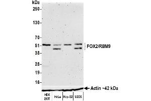 Western Blotting (WB) image for anti-RNA Binding Motif Protein 9 (RBM9) (AA 1-50) antibody (ABIN7454009) (Recombinant RBM9 antibody  (AA 1-50))