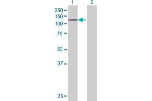 Lane 1: RASA1 transfected lysate ( 100. (RASA1 293T Cell Transient Overexpression Lysate(Denatured))