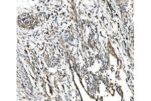 IHC analysis of GFPT1 using anti-GFPT1 antibody (ABIN7602887).