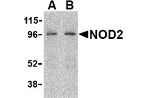 Image no. 2 for anti-Nucleotide-Binding Oligomerization Domain Containing 2 (NOD2) (C-Term) antibody (ABIN372922) (NOD2 antibody  (C-Term))