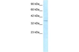 Western Blotting (WB) image for anti-NLR Family, CARD Domain Containing 4 (NLRC4) antibody (ABIN2463643) (NLRC4 antibody)