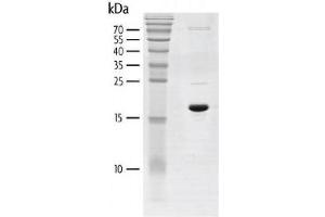 Recombinant BRD3 (306-416) protein gel. (BRD3 Protein (AA 306-416) (His tag,DYKDDDDK Tag))