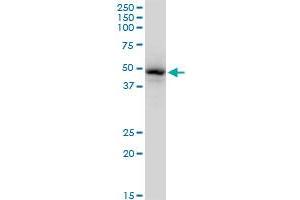 GATA1 monoclonal antibody (M06), clone 3G6. (GATA1 antibody  (AA 123-199))