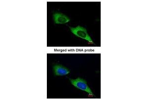 ICC/IF Image Immunofluorescence analysis of paraformaldehyde-fixed HeLa, using MTMR9, antibody at 1:200 dilution. (MTMR9 antibody  (C-Term))