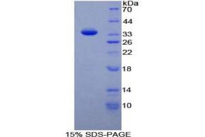 SDS-PAGE analysis of Human TAF1 Protein. (TAF1 Protein)