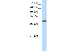 WB Suggested Anti-APTX Antibody Titration:  2. (Aprataxin antibody  (C-Term))
