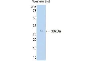 Detection of Recombinant MCSFR, Mouse using Polyclonal Antibody to Colony Stimulating Factor Receptor, Macrophage (MCSFR) (CSF1R antibody  (AA 639-868))