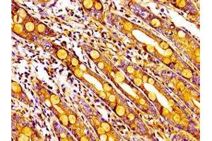 Immunohistochemistry of paraffin-embedded human small intestine tissue using ABIN7142689 at dilution of 1:100 (MPP1 antibody  (AA 123-252))