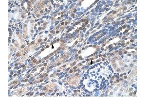 NOLC1 antibody was used for immunohistochemistry at a concentration of 4-8 ug/ml to stain Epithelial cells of renal tubule (arrows) in Human Kidney. (NOLC1 antibody  (C-Term))