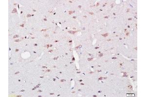 Paraformaldehyde-fixed, paraffin embedded rat brain tissue, Antigen retrieval by boiling in sodium citrate buffer(pH6) for 15min, Block endogenous peroxidase by 3% hydrogen peroxide for 30 minutes, Blocking buffer (normal goat serum) at 37°C for 20min, Antibody incubation with Rabbit Anti-UBE2Q1 Polyclonal Antibody, Unconjugated  at 1:500 overnight at 4°C, followed by a conjugated secondary and DAB staining (UBE2Q1 antibody  (AA 321-422))