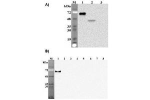 Western blot analysis of human Pref-1using anti-DLK1 (human), mAb  (PF299-1)  at 1: 2,000 dilution. (DLK1 antibody  (Extracellular Domain))