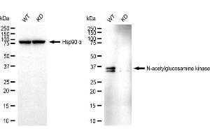 Western blotting analysis using N-acetylglucosamine kinase antibody (ABIN7799529). (NAGK antibody)