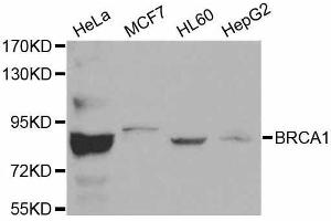 Western blot analysis of extracts of various cell lines, using BRCA1 antibody. (BRCA1 antibody  (AA 120-220))