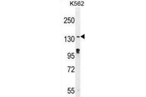 Western Blotting (WB) image for anti-OVOS1 antibody (ABIN2996287) (OVOS1 antibody)