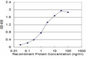 Detection limit for recombinant GST tagged GATA3 is approximately 0. (GATA3 antibody  (AA 103-200))