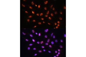 Immunofluorescence analysis of C6 cells using YY2 Rabbit pAb (ABIN7271429) at dilution of 1:100. (YY2 antibody  (AA 200-300))