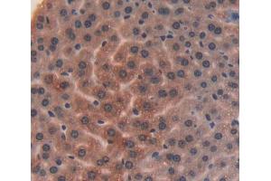 Used in DAB staining on fromalin fixed paraffin- embedded liver tissue (ITIH4 antibody  (AA 721-942))