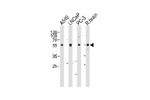 Western blot analysis of lysates from A549, LNCaP, PC-3 cell line and rat brain tissue lysate (from left to right), using ADRA1D Antibody (N-term) (ABIN1945085 and ABIN2838547). (ADRA1D antibody  (N-Term))