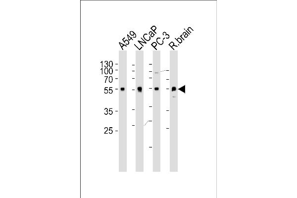 ADRA1D Antikörper  (N-Term)