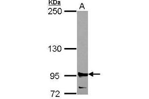 WB Image Sample (30 ug of whole cell lysate) A: 293T 5% SDS PAGE antibody diluted at 1:2000 (RRM1 antibody  (Center))