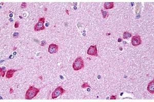 Anti-MLKL antibody IHC staining of human brain, cortex neurons. (MLKL antibody  (AA 371-472))