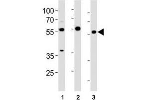 HDAC antibody western blot analysis in (1) HeLa cell line and (2) mouse testis, (3) rat testis tissue lysate. (HDAC1 antibody  (AA 402-430))