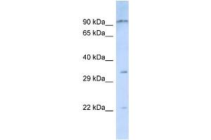 Host:  Rabbit  Target Name:  NIPSNAP3B  Sample Type:  Jurkat Whole Cell lysates  Antibody Dilution:  1.