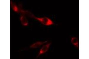 ABIN6274803 staining HepG2 cells by IF/ICC. (ACBD6 antibody  (Internal Region))
