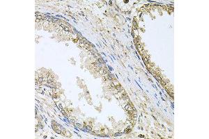 Immunohistochemistry of paraffin-embedded human prostate using CYP46A1 antibody (ABIN5996079) at dilution of 1/100 (40x lens). (CYP46A1 antibody)