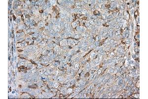 Immunohistochemistry (IHC) image for anti-Aldehyde Dehydrogenase 3 Family, Member A1 (ALDH3A1) antibody (ABIN1496591) (ALDH3A1 antibody)