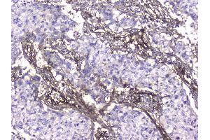Immunohistochemistry (IHC) image for anti-Collagen, Type IV, alpha 1 (COL4A1) (AA 1445-1669) antibody (ABIN5692826)