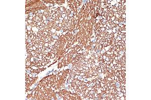 Immunohistochemistry (IHC) image for anti-Syntaxin 1B (STX1B) antibody (ABIN7270685)
