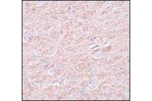 Immunohistochemistry of PRDM16 in rat brain tissue with AP30689PU-N PRDM16 antibody at 2. (PRDM16 antibody  (C-Term))