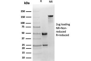 SDS-PAGE Analysis Purified MICA Mouse Recombinant Monoclonal (MICA/4442). (MICA antibody  (AA 1-200))