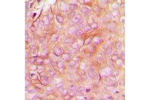 Immunohistochemistry (IHC) image for anti-Stathmin 1 (STMN1) (N-Term), (pSer16) antibody (ABIN7303732)
