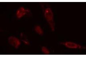 ABIN6275433 staining  COLO205 cells by IF/ICC. (CHML antibody  (Internal Region))