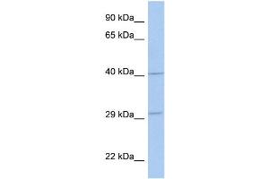 WB Suggested Anti-ART5 Antibody Titration:  0. (ART5 antibody  (Middle Region))