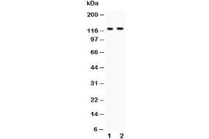Western blot testing of BOC antibody and Lane 1:  mouse brain;  2: NIH3T3 lysate. (BOC antibody  (AA 1002-1020))