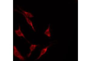 ABIN6267663 staining HeLa by IF/ICC. (LKB1 antibody  (pThr189))