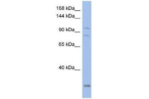 KCNQ5 antibody used at 1 ug/ml to detect target protein.