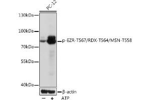 Western blot analysis of extracts of PC-12 cells, using Phospho-EZR-T567/RDX-T564/MSN-T558 Rabbit pAb (ABIN7267075) at 1:1000 dilution. (EZR/RDX/MSN (pThr558) antibody)
