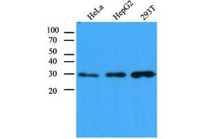 Western Blotting (WB) image for anti-Carbonyl Reductase 1 (CBR1) antibody (ABIN614309) (CBR1 antibody)