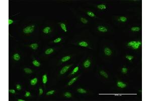 Immunofluorescence of purified MaxPab antibody to ARL6IP4 on HeLa cell. (ARL6IP4 antibody  (AA 1-360))