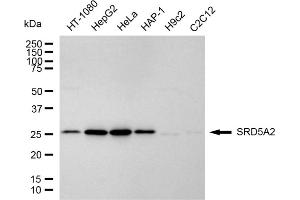 anti-Steroid-5-alpha-Reductase, alpha Polypeptide 2 (3-Oxo-5 alpha-Steroid delta 4-Dehydrogenase alpha 2) (SRD5A2) antibody